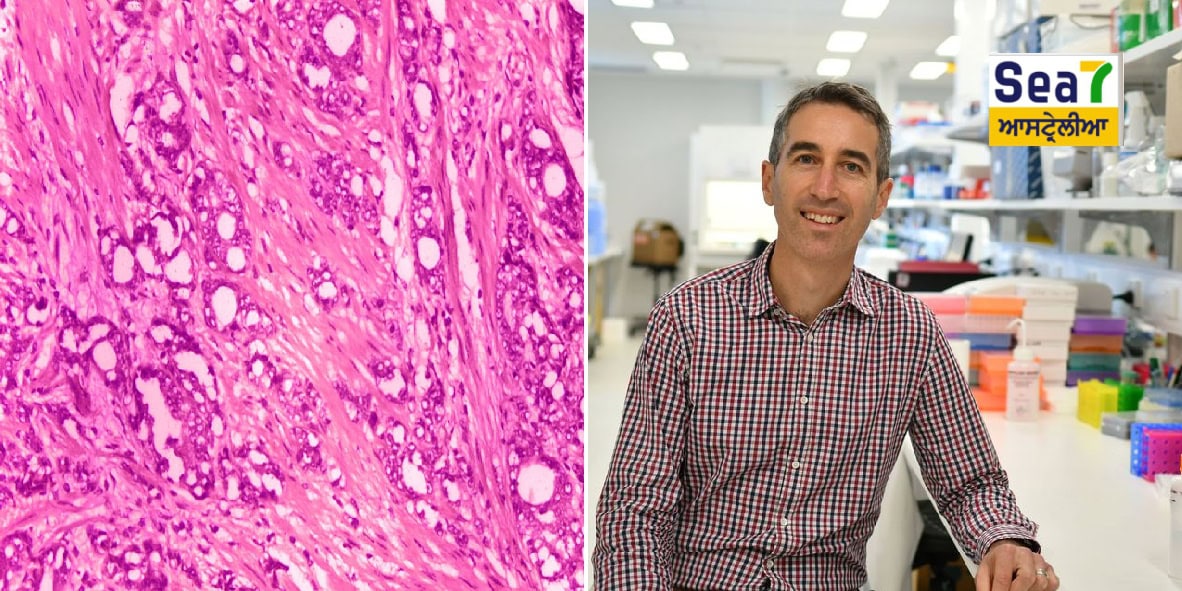 ਪ੍ਰੋਸਟੇਟ ਕੈਂਸਰ